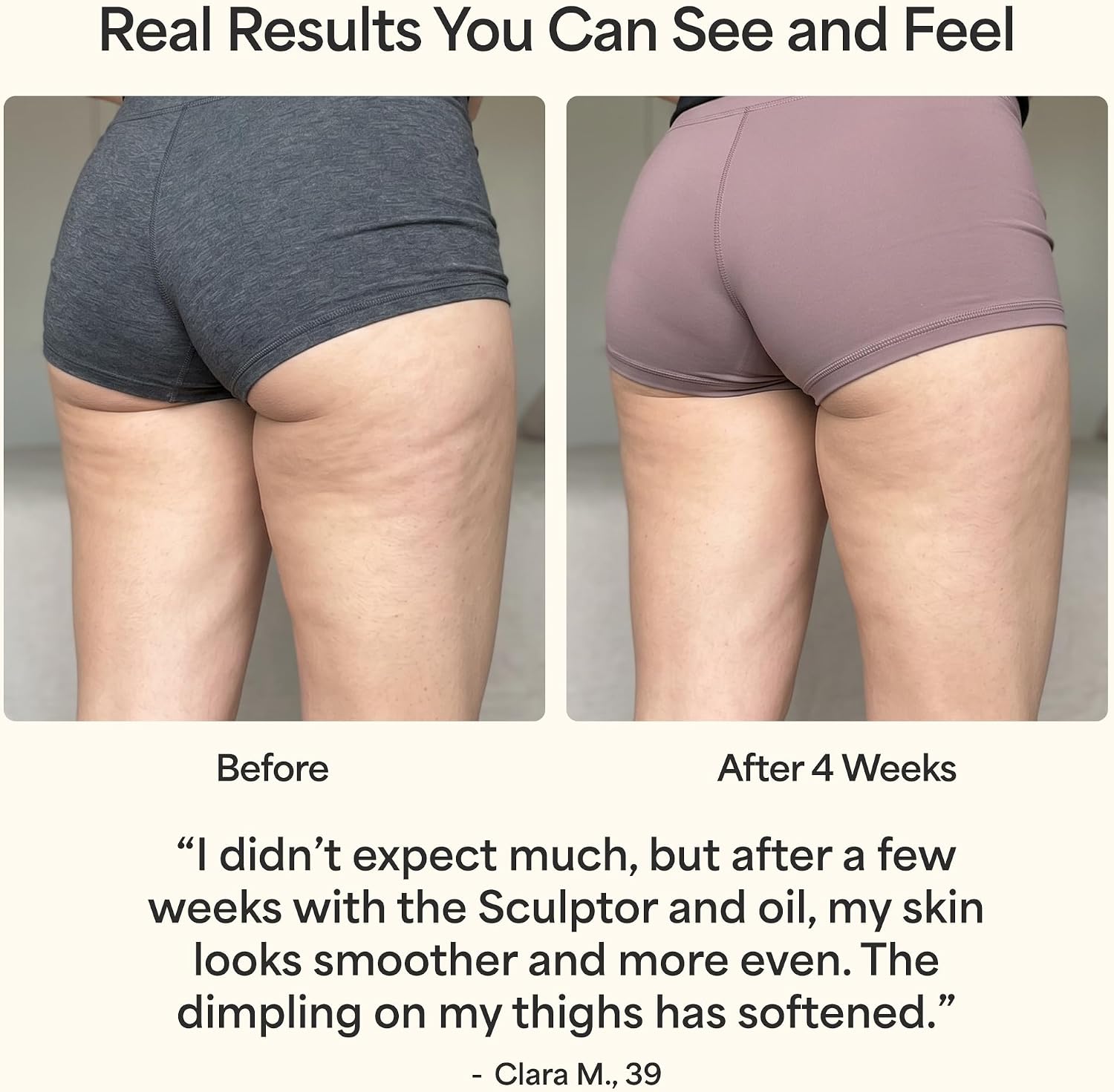 REVO-supplied before and after 4 weeks comparison of the back of the thighs with a testimonial from Clara M., 39