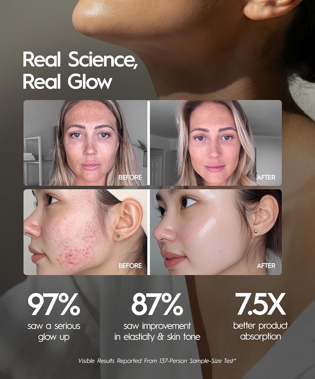 REVO Face Genie before and after results reported by the manufacturer
